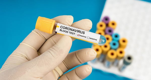 Corona blood test kit